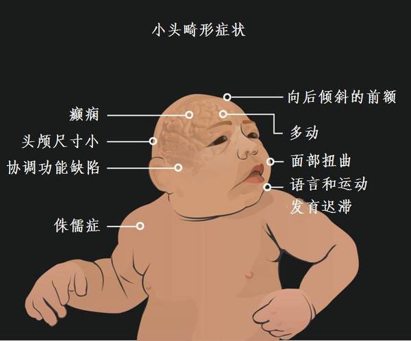 苯污染,笨危害,成都裝修